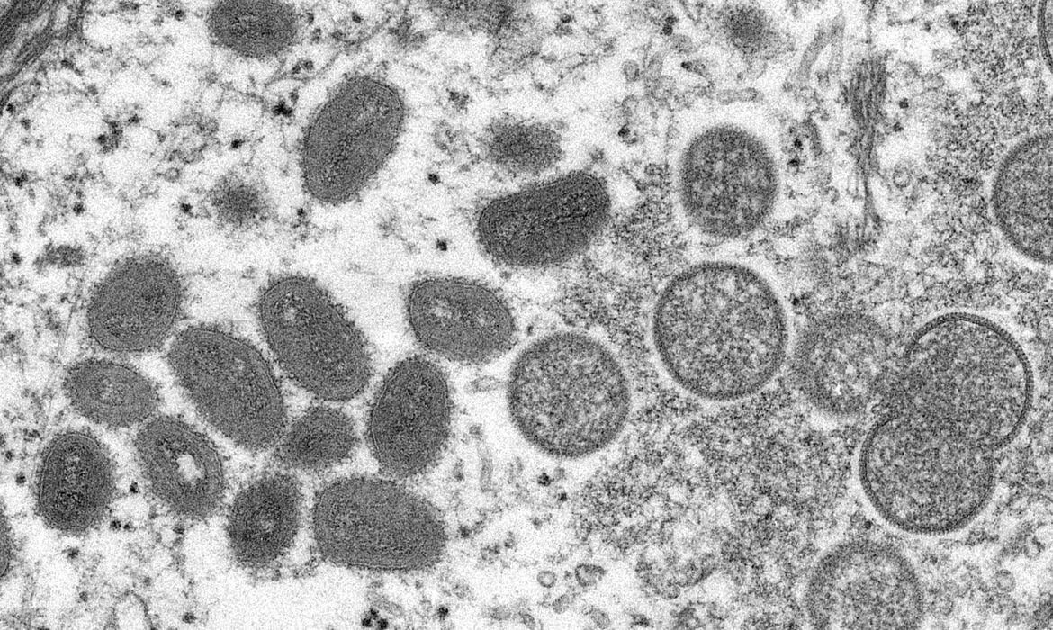 Foto em preto e branco mostra vírus monkeypox visto em microscópio.