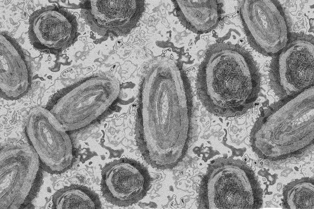 Vírus monkeypox visto em microscópio.