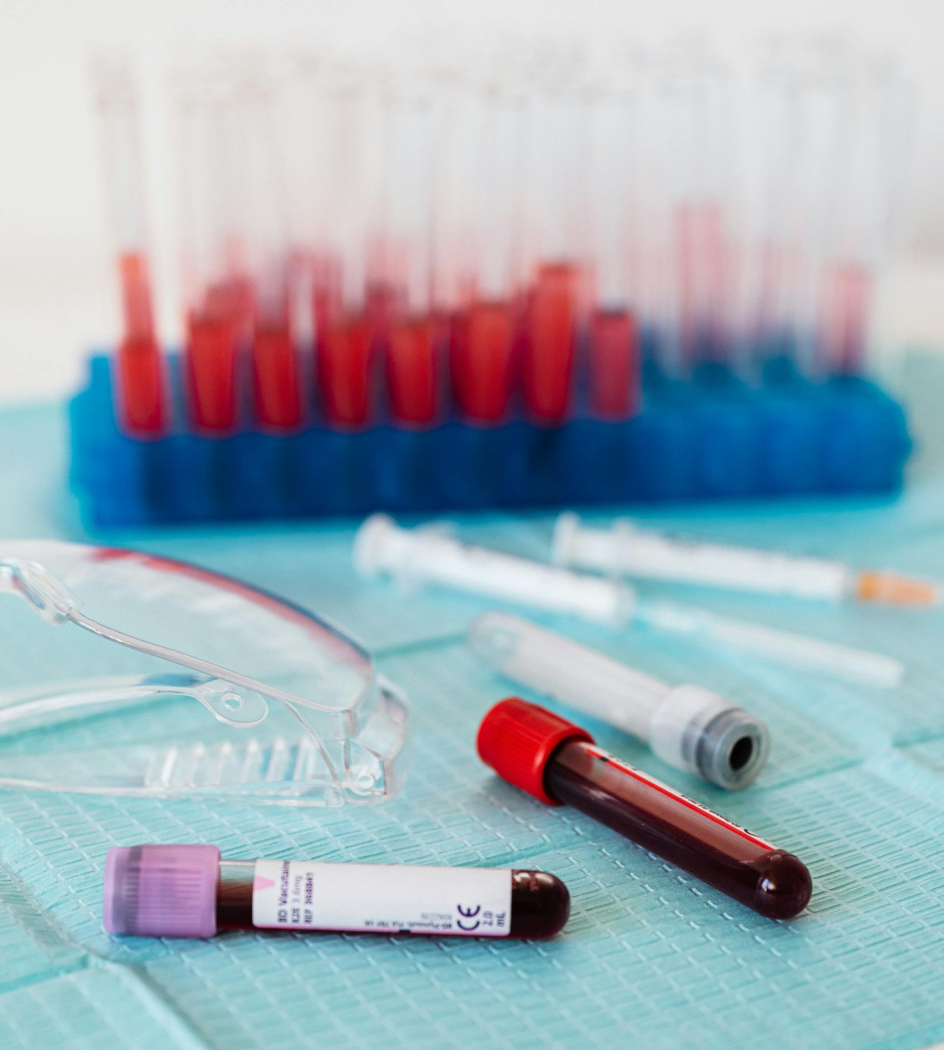provetas com sangue de exame laboratorial