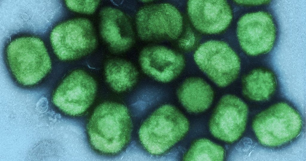 Micrografia eletrônica de partículas do vírus Monkeypox; Cruzeiro acaba de registrar primeiro caso da doença