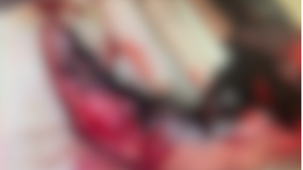 Homem "explode" a própria mão ao tentar remover pedra em Cunha